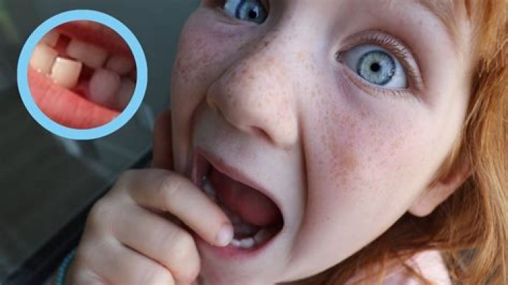 Are your teeth supposed to wiggle?