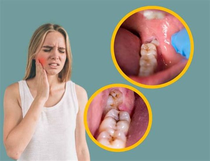 Can I wait out tooth pain?