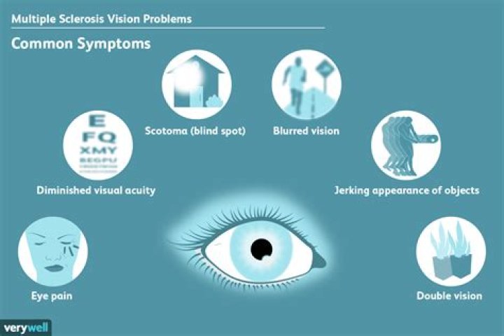 Can MS eye problems be treated?