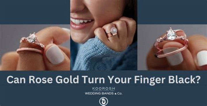 Can real gold turn your skin black?