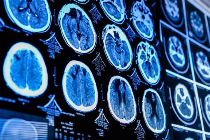 Can viruses hide from scans?