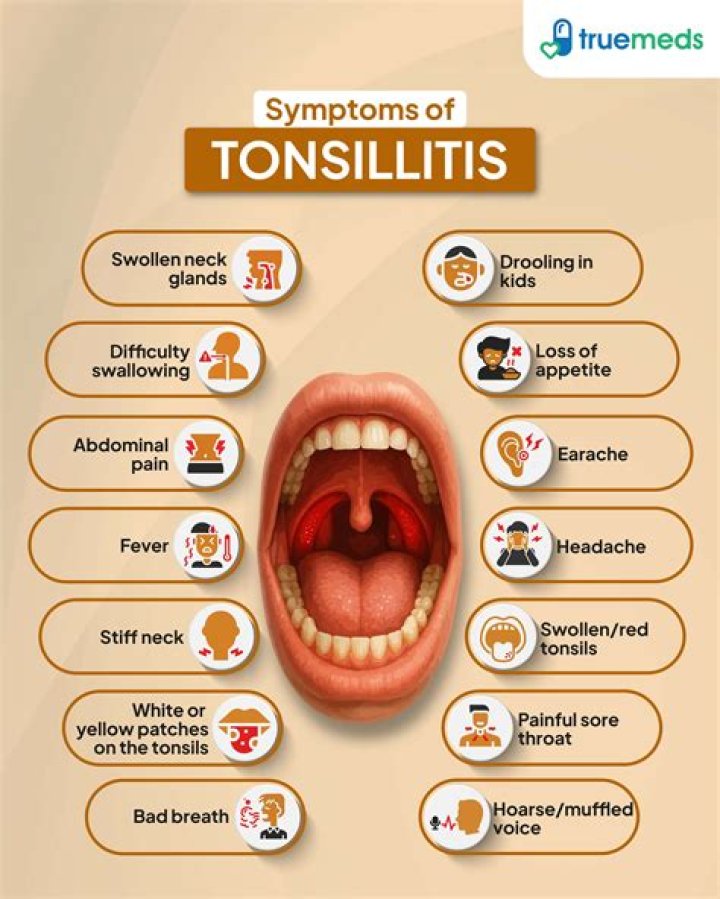 Can white spots on tonsils be viral?