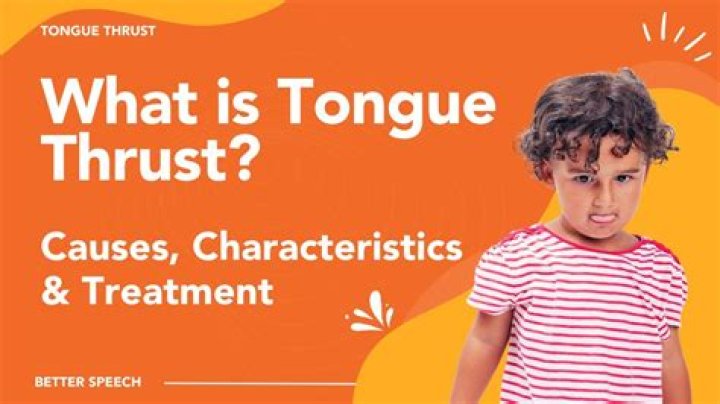 Can you fix tongue thrust?