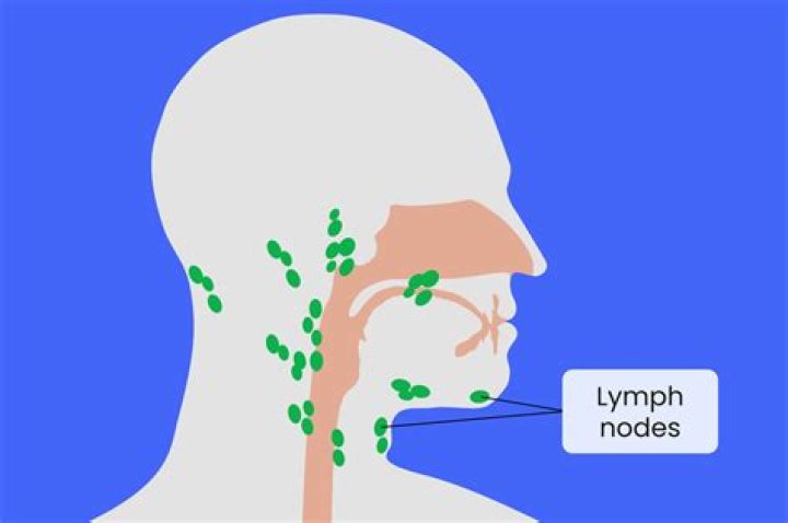 Do lymph nodes swell before you get sick?