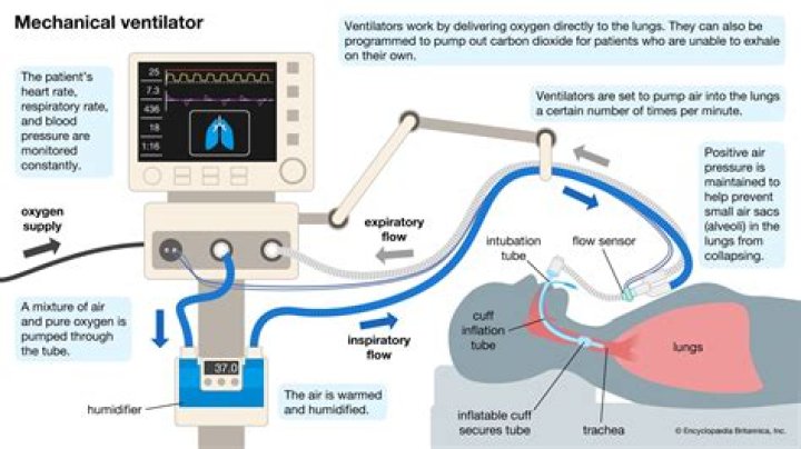 Do ventilators go down your throat?