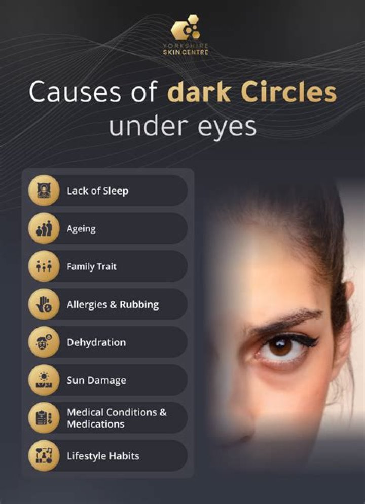 Do worms cause dark circles?