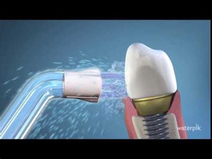 Does a WaterPik remove plaque?