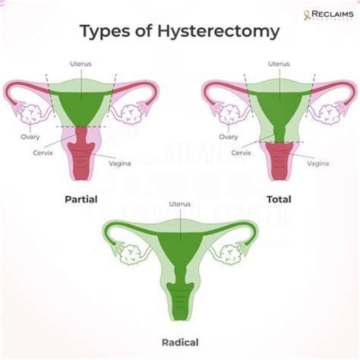 Does having a hysterectomy affect your hair?