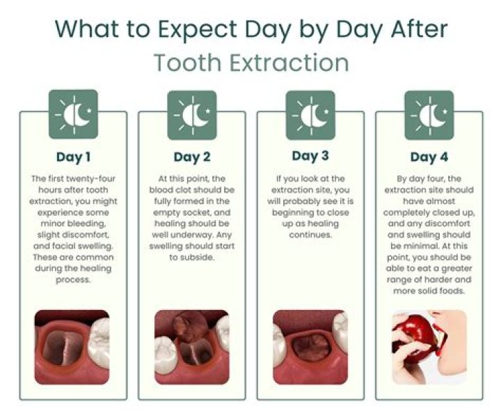 Does having a tooth removed affect other teeth?