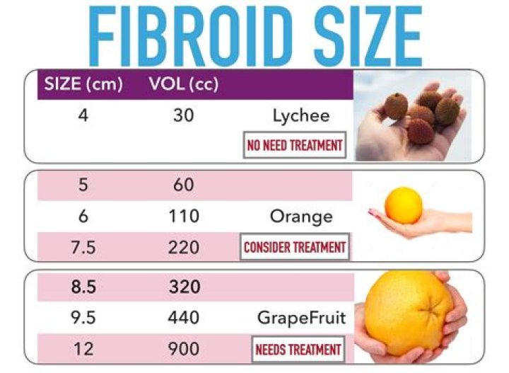 How big is a 3 cm fibroid?