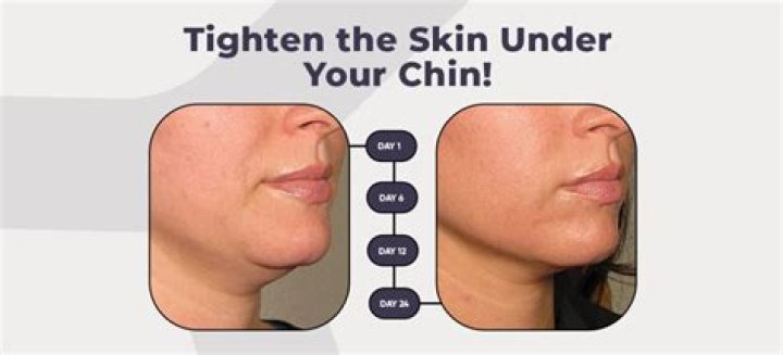 How can I tighten the skin around my mouth?