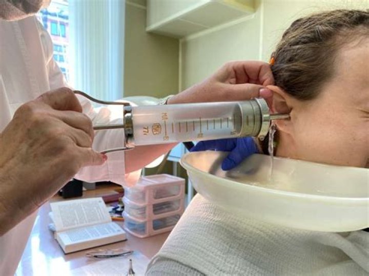 How do doctors syringe ear wax?