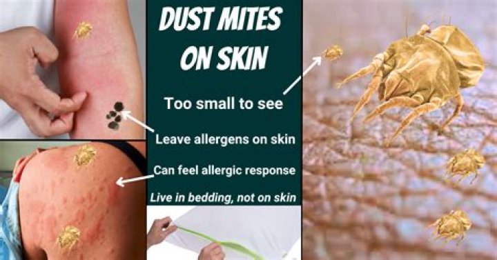 How do I know if I have dust mites?
