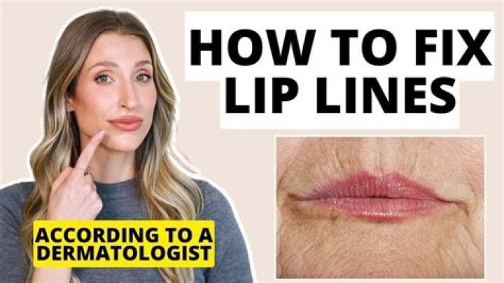 How do you get big lines on your lips?