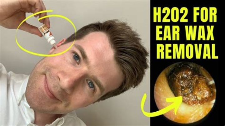 How does Otex remove ear wax?