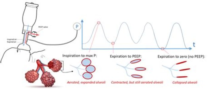 How does PEEP affect BP?