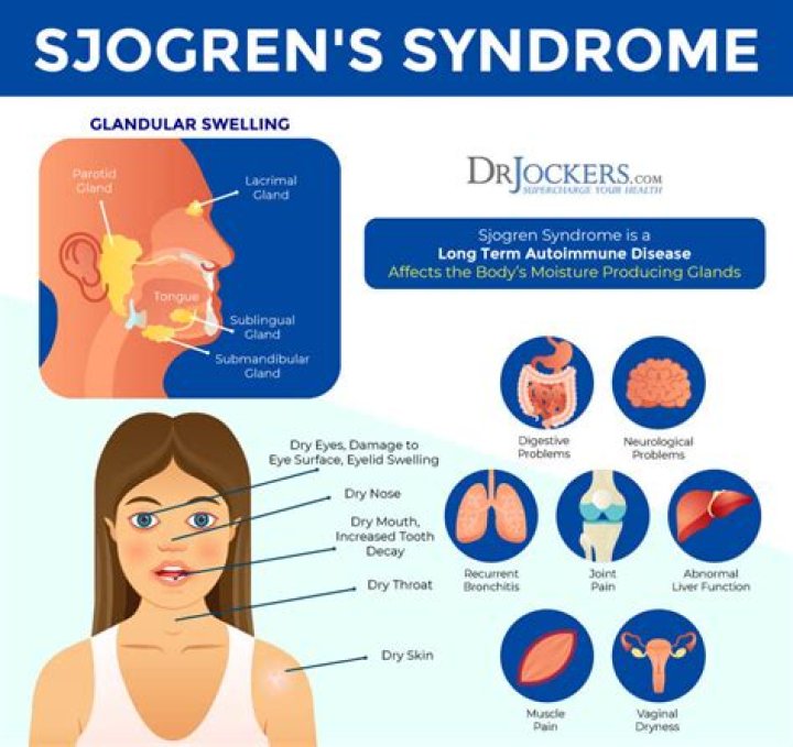 How does Sjogren's affect the stomach?