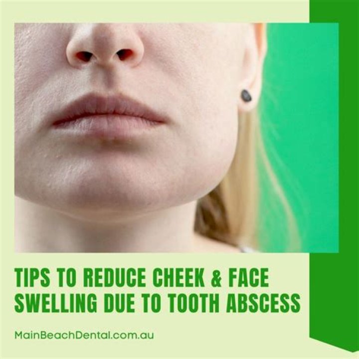 How long does it take for antibiotics to reduce swelling in face?