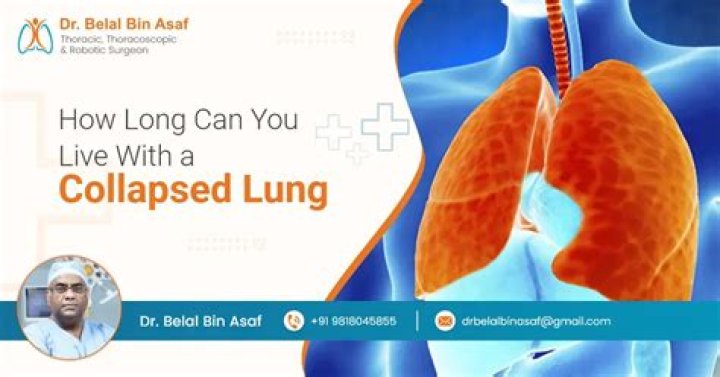 How many years can you live with a stent?