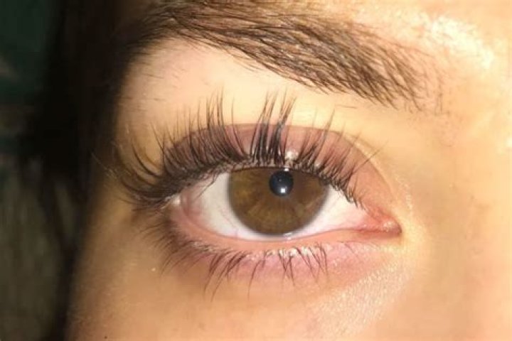 Is having long eyelashes rare?