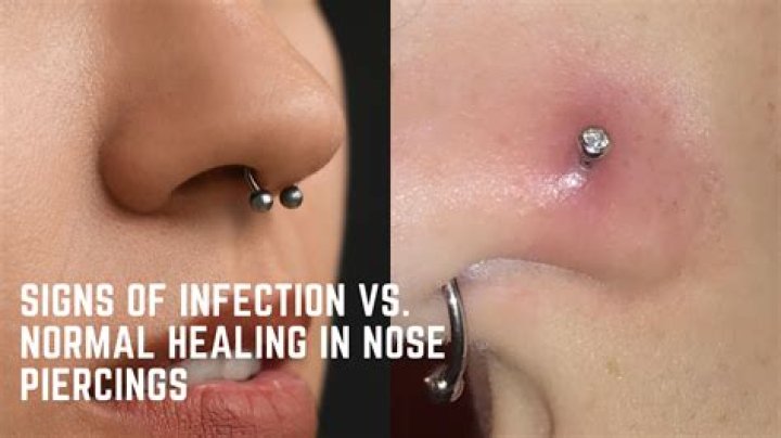 Is it normal for a new piercing to bleed?