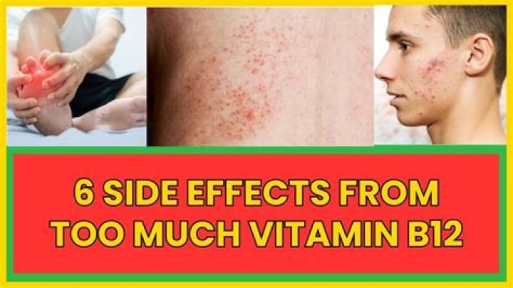 What are the symptoms of too much vitamin B6?