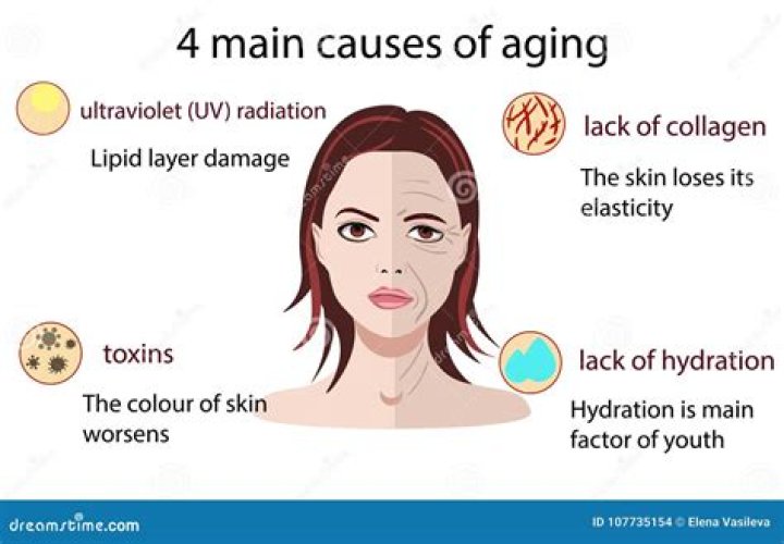 What causes aging?