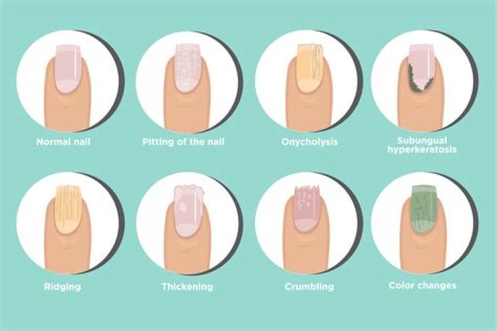 What does a nail symbolize?