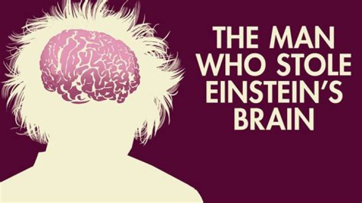 What happened to Albert Einstein's brain?