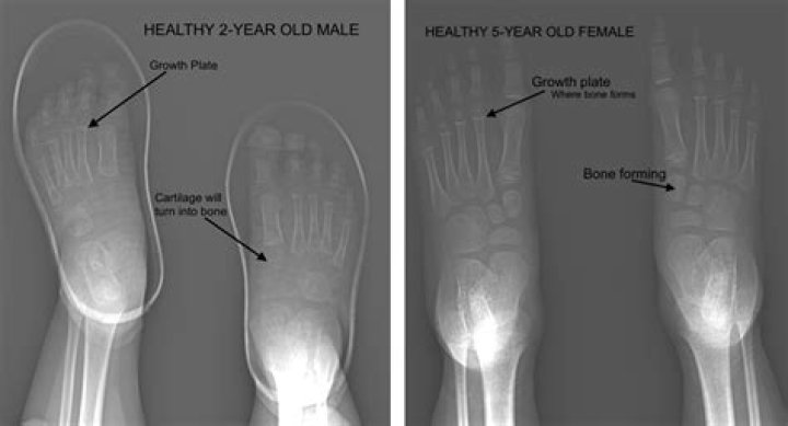 What happens to aging feet?