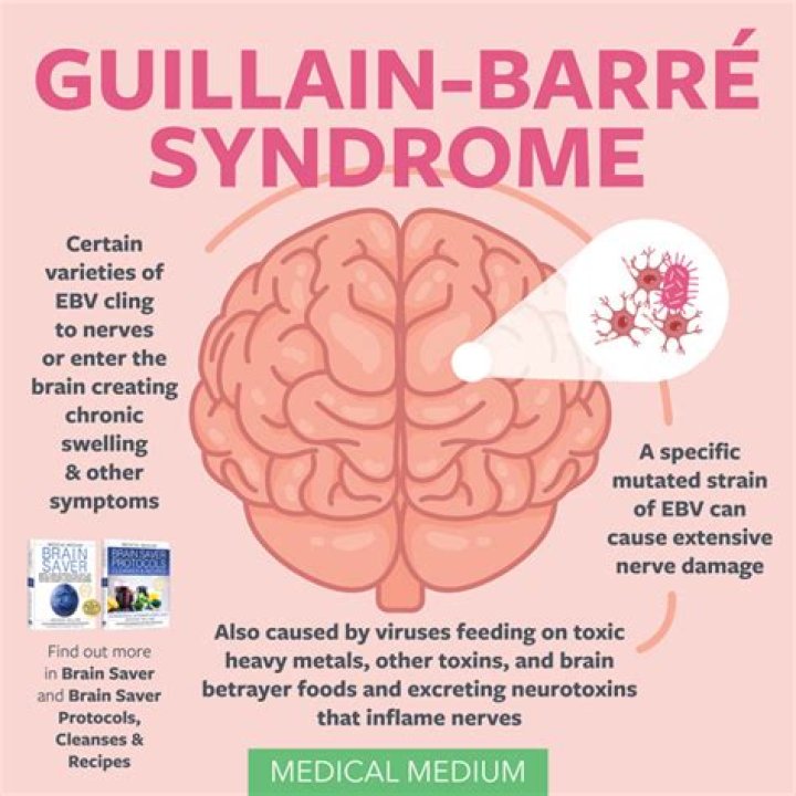 When does Guillain-Barré syndrome occur after Covid?