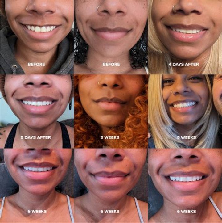 Who does Lip get pregnant?