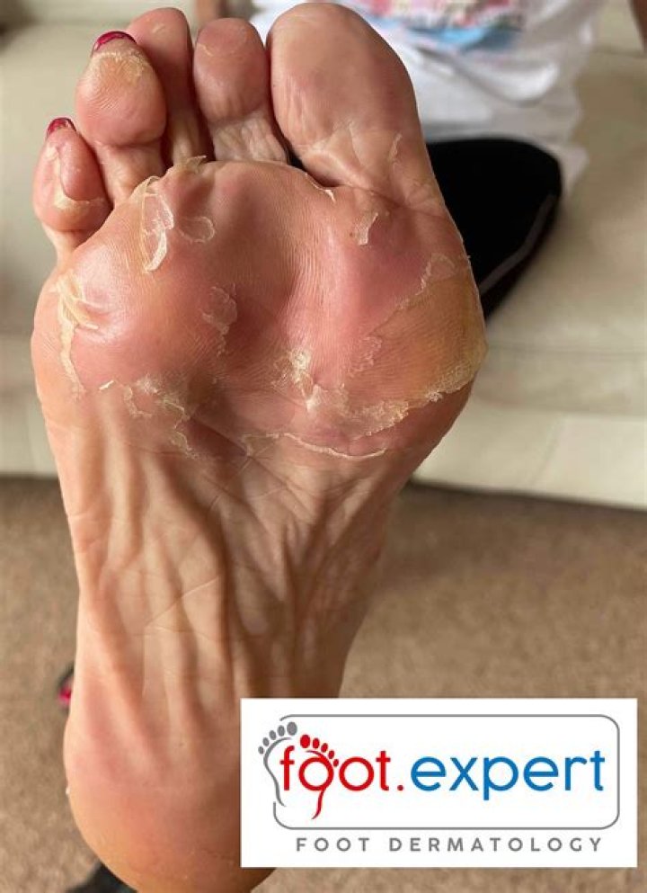 Why are my feet black at the bottom?