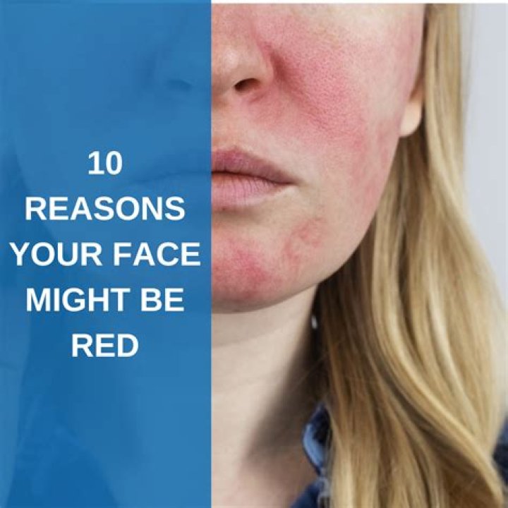 Why do I turn red around my crush?