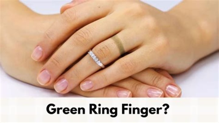 Why is my real gold ring turning my finger green?