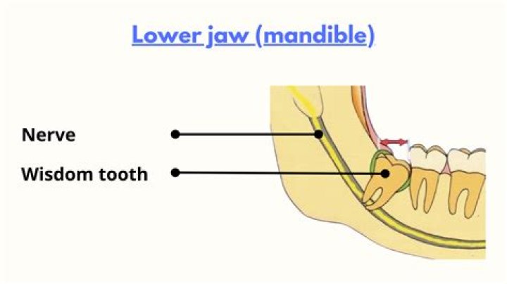 Will a damaged tooth nerve heal?